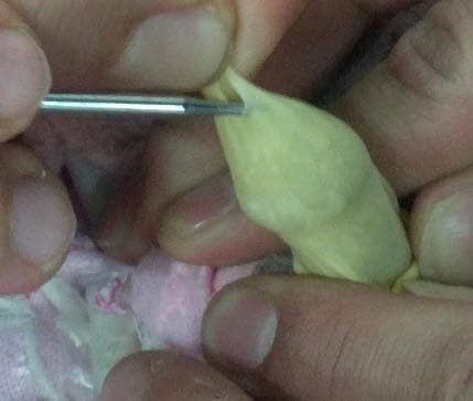 ביצוע מצוות הברית מילה