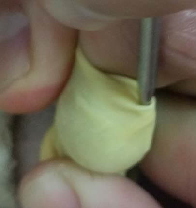 ביצוע מצוות הברית מילה